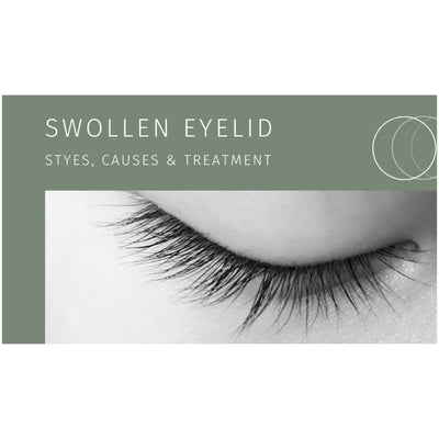 Swollen Eyelid Guide: Styes, Causes & Treatment