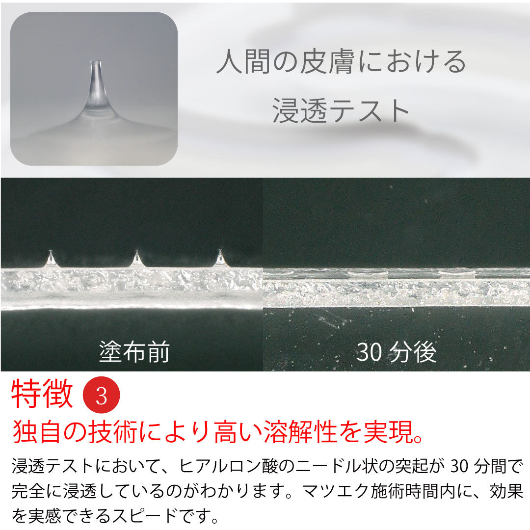 Matsukaze Micro needle Eyepatch 5pieces